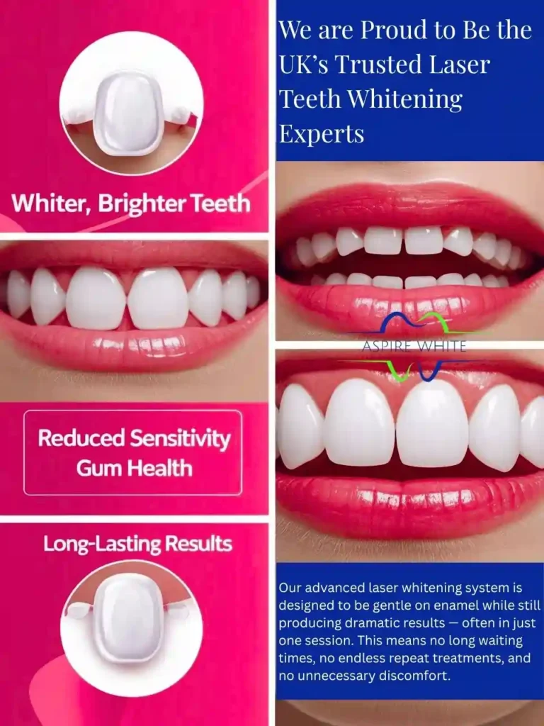 We are Proud to Be the UK’s Trusted Laser Teeth Whitening Experts Towcester