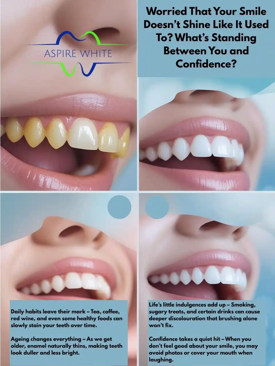 Worried That Your Smile Doesn’t Shine Like It Used To What’s Standing Between You and Confidence Towcester
